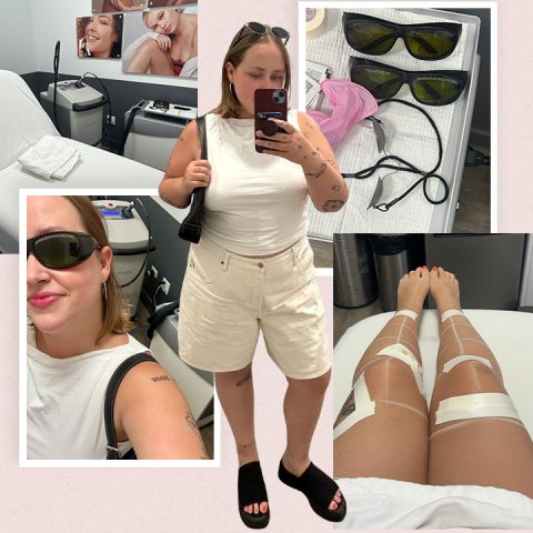 Laser Hair Removal vs. Waxing